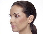 Facial lines & wrinkles